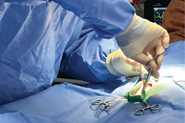 外科的人工授精（SAI）の手術イメージ